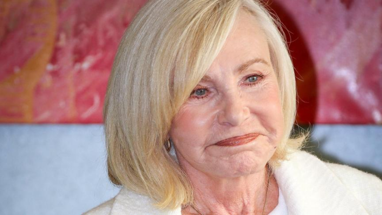 Michèle Torr accro à la chirurgie esthétique ?